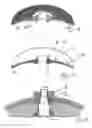 Fig. 06 - Implant with a skin penetration section