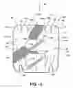 Fig. 04 - PIV dressing assembly