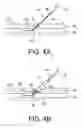 Fig. 06 - Apparatus and methods for delivering sealing materials during a percutaneous procedure to facilitate hemostasis