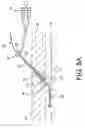 Fig. 09 - Apparatus and methods for delivering sealing materials during a percutaneous procedure to facilitate hemostasis