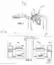 Fig. 02 - System and method for unscheduled wireless communication with a medical device