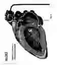 Fig. 09 - Methods and devices for mapping the ventricle for pacing lead placement and therapy delivery