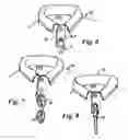 Fig. 03 - Portable securement system