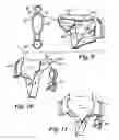 Fig. 04 - Portable securement system