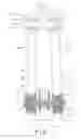 Fig. 02 - Rotary device having laterally movable axle