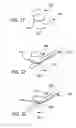 Fig. 22 - Apparatus for forming barbs on a suture