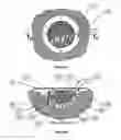 Fig. 07 - Wound cleansing apparatus with scaffold