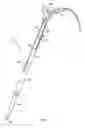 Fig. 02 - Device and method for use in parietal surgery