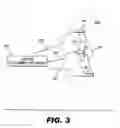Fig. 04 - Methods and systems for placing an implanted stimulator for stimulating tissue