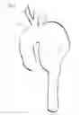 Fig. 02 - Method for aortic graft installation