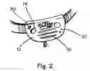 Fig. 03 - Electronic talking pet collar