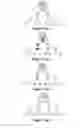 Fig. 08 - System and method for control tree compression