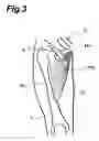 Fig. 04 - Crotch-possessing garment