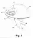 Fig. 07 - Vacuum cleaner with two stage filtration