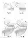 Fig. 09 - Impact absorbing composite hoof pad and method