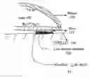 Fig. 01 - Input device with reduced friction