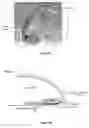 Fig. 09 - Input device with reduced friction