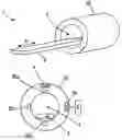 Fig. 01 - MRI system with RF receiver coils fixed to the housing