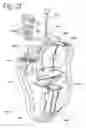Fig. 06 - Silicon-based transducer for use in hearing instruments and listening devices