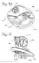 Fig. 09 - Silicon-based transducer for use in hearing instruments and listening devices