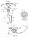 Fig. 02 - Method and apparatus for installation of dental implant