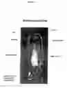 Fig. 02 - Administering pharmaceutical compositions to the mammalian central nervous system
