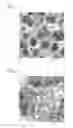Fig. 02 - Microporous composite membrane and its production method and use