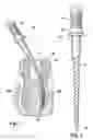 Fig. 02 - Method of preparing nickel titanium alloy for use in manufacturing instruments with improved fatigue resistance