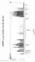 Fig. 362 - Novel genetic markers for leukemias