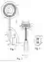Fig. 02 - Mechanical anal incontinence