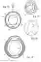 Fig. 06 - Mechanical anal incontinence