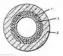 Fig. 01 - Orthopedic cast system and method