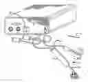 Fig. 01 - Method and apparatus for an ocular procedure