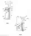 Fig. 06 - Surgical laser guide and method of use