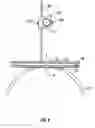 Fig. 09 - Surgical laser guide and method of use