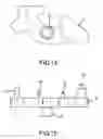 Fig. 05 - Joint prosthesis and method of implanting same