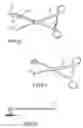 Fig. 10 - Joint prosthesis and method of implanting same