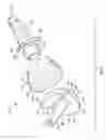Fig. 09 - Radial-capitellar implant