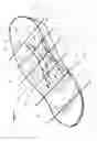 Fig. 02 - ORTHOTIC DEVICE