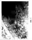 Fig. 02 - Characterization of microbial deposition and immune response at the basement membrane and methods relating thereto
