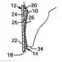 Fig. 01 - Strips for treating teeth