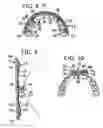 Fig. 03 - Strips for treating teeth