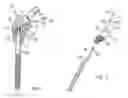 Fig. 02 - Separator tool for a modular prosthesis