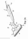 Fig. 02 - Tool and method for implanting an annuloplasty prosthesis