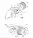 Fig. 08 - Sprinkler head with improved flow