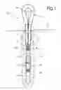 Fig. 02 - Wire rope anchor, in particular for rockfall or avalanche protection systems
