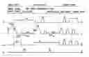 Fig. 01 - Plasma display device and driving method thereof