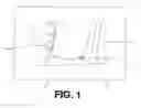 Fig. 02 - Method and system for processing an image of body tissues