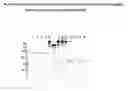 Fig. 01 - Drosophila cell lines producing recombinant secretable filovirus surface glycoproteins lacking the membrane spanning domain