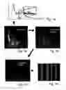 Fig. 02 - Device and process for the quantitative evaluation of the polypeptides and markers contained in a sample of body fluid for recognizing pathological conditions